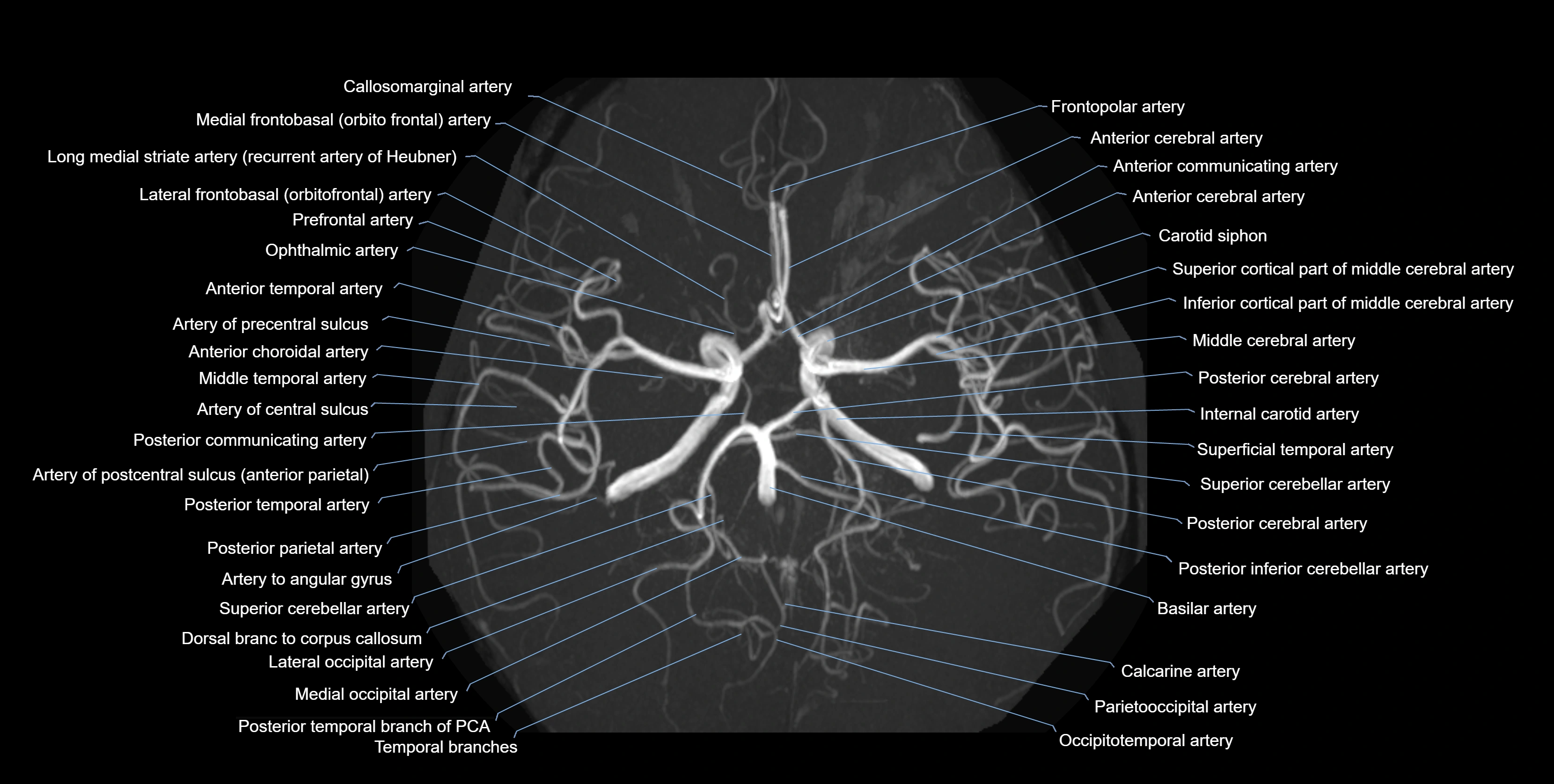 MRA brain axial MIP labelled  anatomy 3T MRI images -img-01021-00002.webp